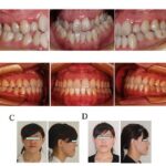 In & Ex Oral Photos - Day1